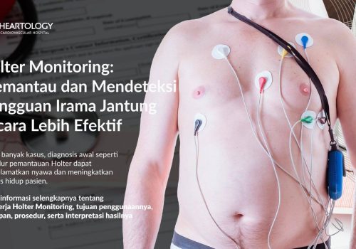 Holter Monitoring: Memantau dan Mendeteksi Gangguan Irama Jantung Secara Lebih Efektif
