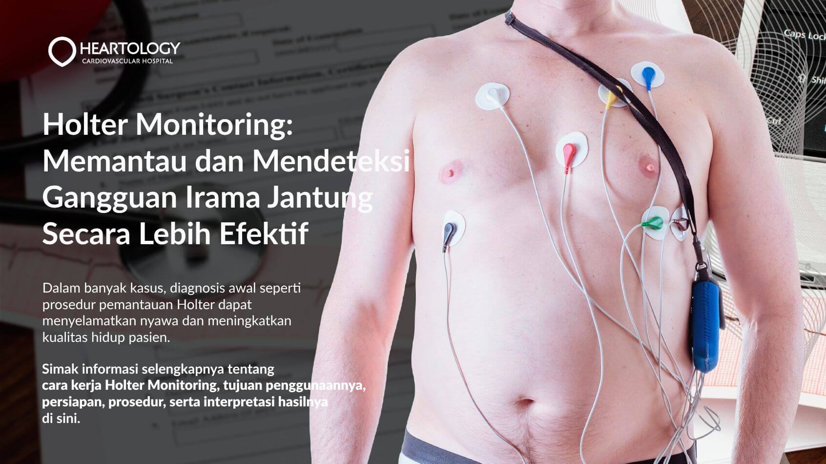 Holter Monitoring: Memantau dan Mendeteksi Gangguan Irama Jantung Secara Lebih Efektif