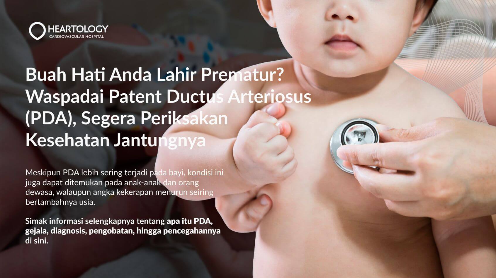 Patent Ductus Arteriosus (PDA): Kenali Gejala, Penanganan, dan Pencegahannya