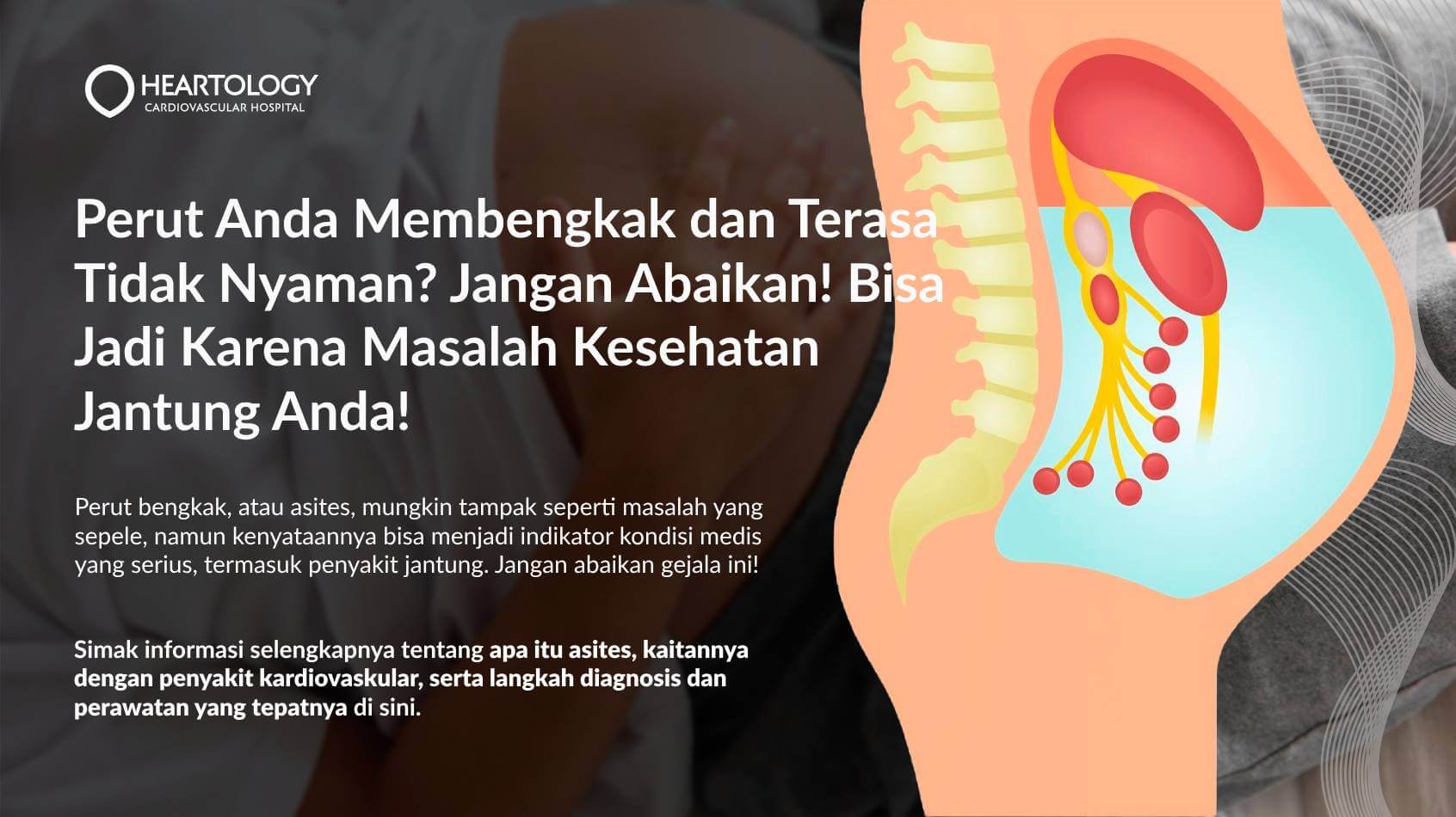 Perut Bengkak (Asites): Penyebab, Gejala, Diagnosis, dan Pengobatannya