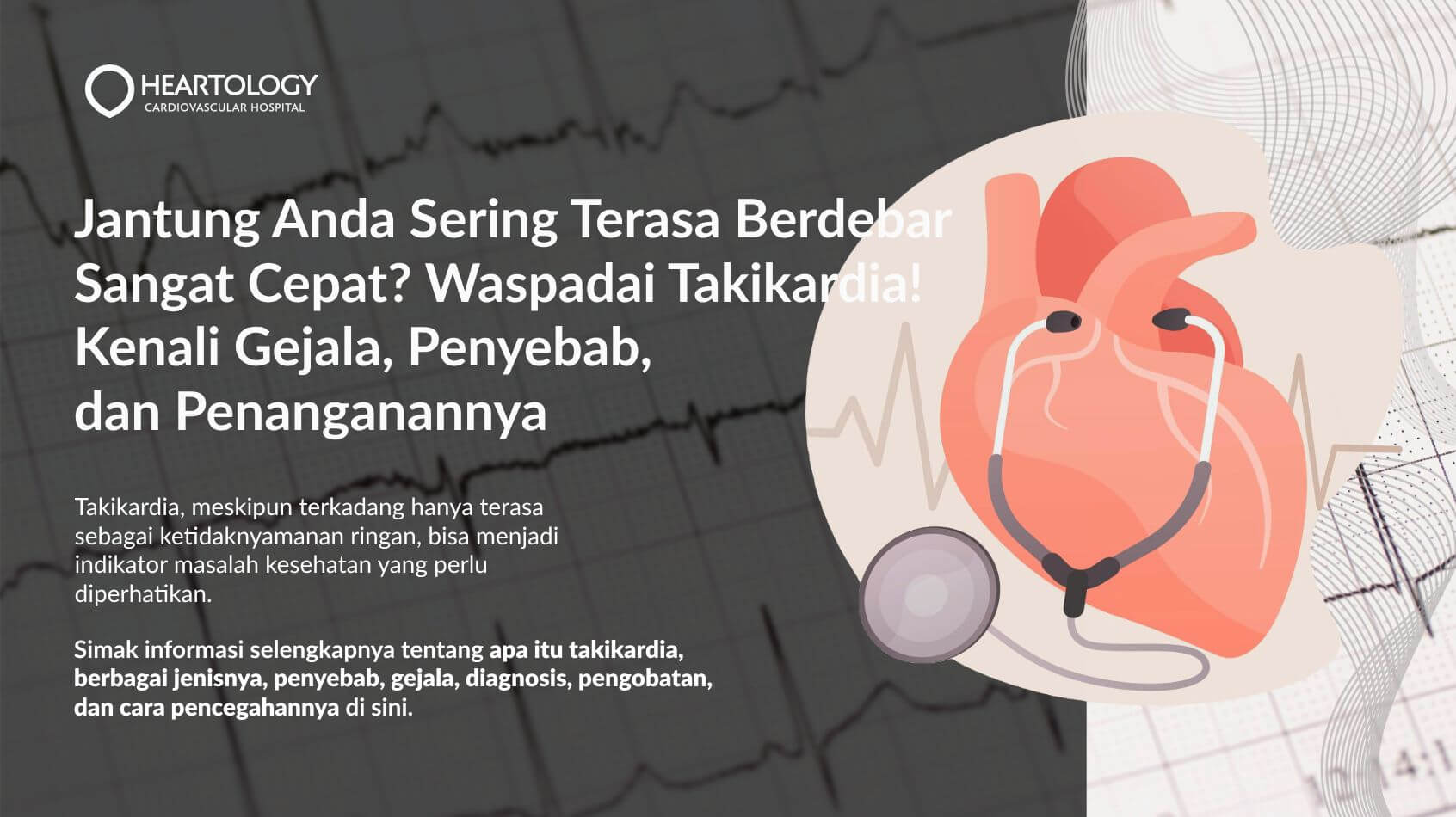 Takikardia: Gejala, Penyebab, Pengobatan, dan Pencegahannya