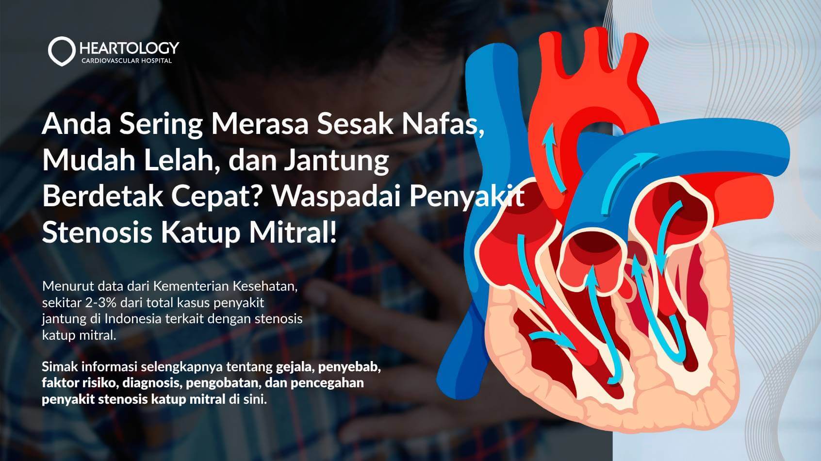 Stenosis Katup Mitral: Gejala, Penyebab, Faktor Risiko, dan Pengobatannya