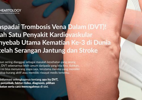 Trombosis Vena Dalam (DVT): Gejala, Penyebab, Pengobatan dan Pencegahannya