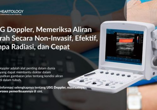 USG Doppler: Fungsi, Cara Kerja, dan Manfaatnya dalam Medis