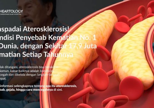 Aterosklerosis: Gejala, Penyebab, Pengobatan dan Pencegahannya