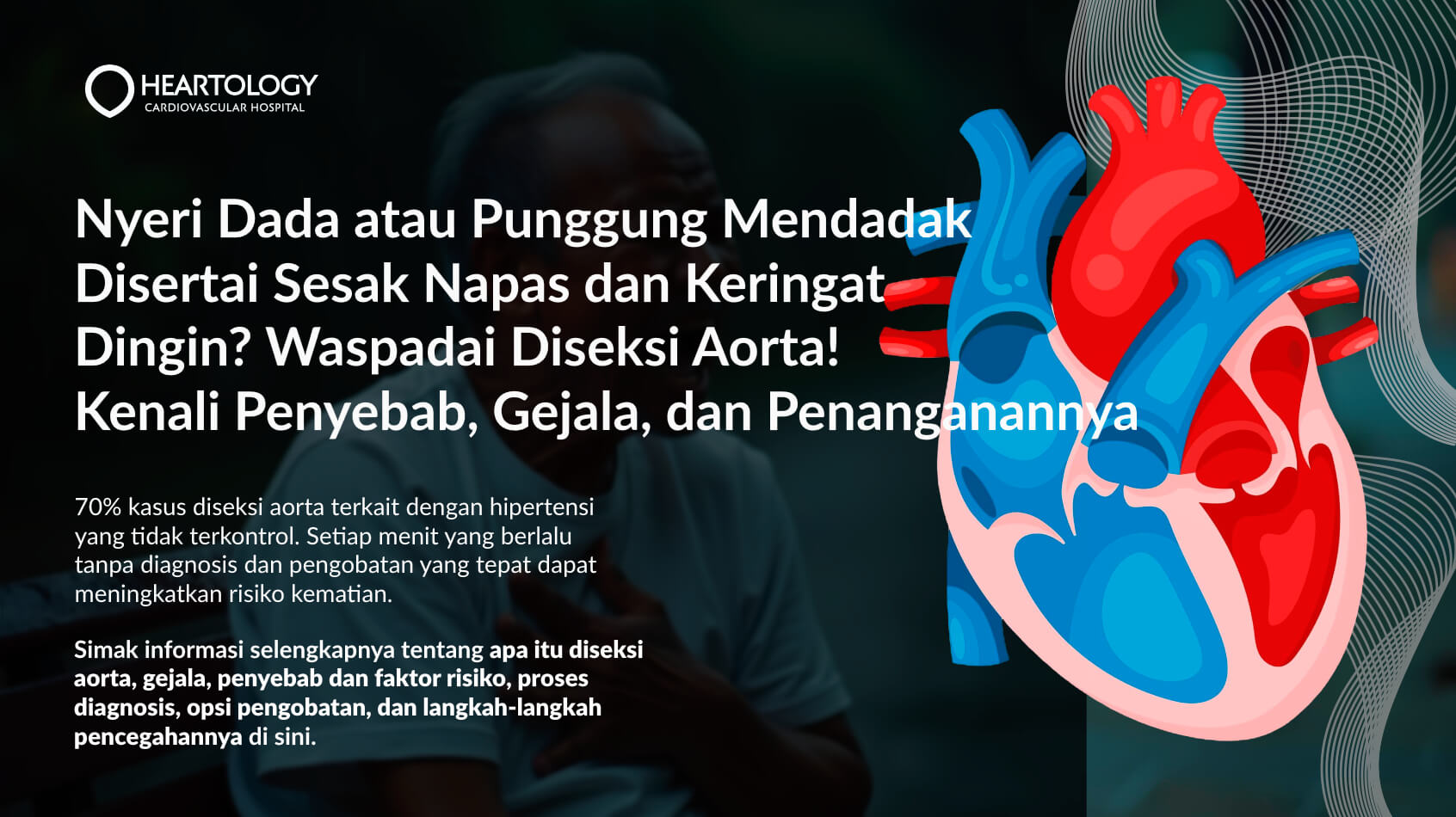 Diseksi Aorta: Gejala, Penyebab, Pengobatan dan Pencegahannya