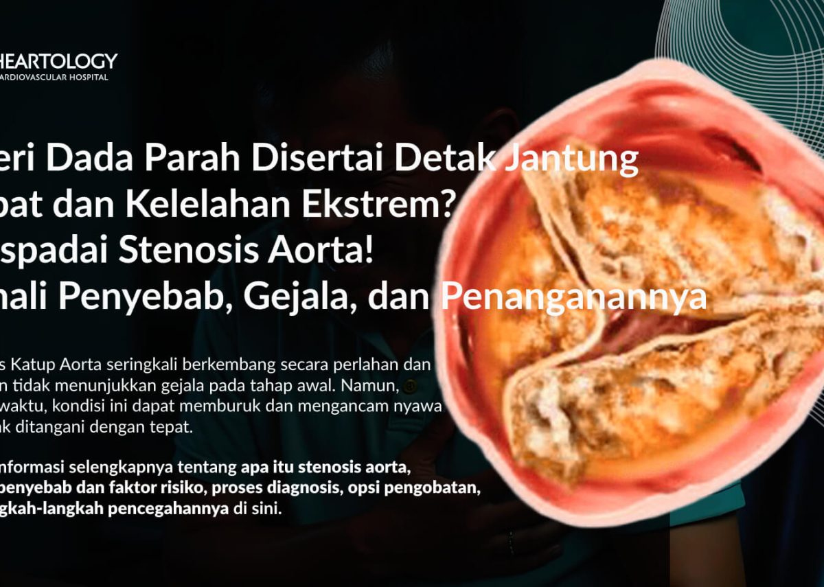Stenosis Aorta: Gejala, Penyebab, Pengobatan dan Pencegahannya