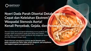 Stenosis Aorta: Gejala, Penyebab, Pengobatan dan Pencegahannya