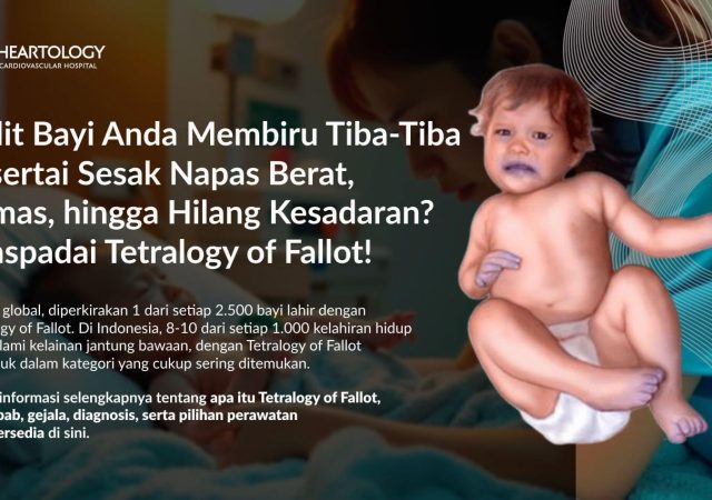 Tetralogy of Fallot: Gejala, Penyebab dan Penanganannya