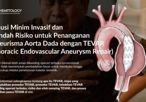 TEVAR (Thoracic Endovascular Aneurysm Repair): Solusi Minim Invasif untuk Aneurisma Aorta Torakalis