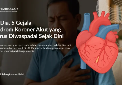 Gejala Sindrom Koroner Akut yang Harus Diwaspadai Sejak Dini