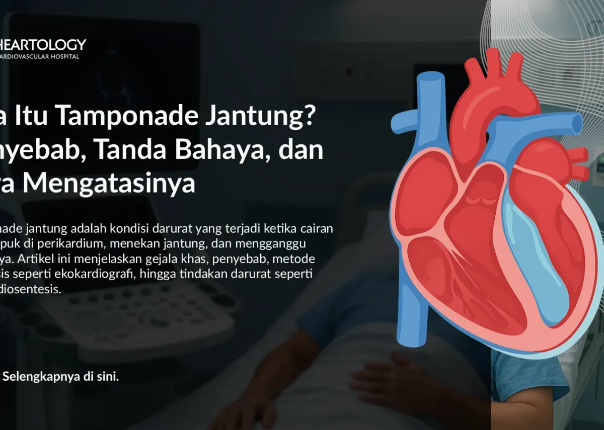 Apa Itu Tamponade Jantung? Penyebab, Tanda Bahaya, dan Cara Mengatasinya