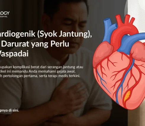 Apa Itu Syok Kardiogenik? Kenali Gejala, Penyebab, dan Pilihan Pengobatan